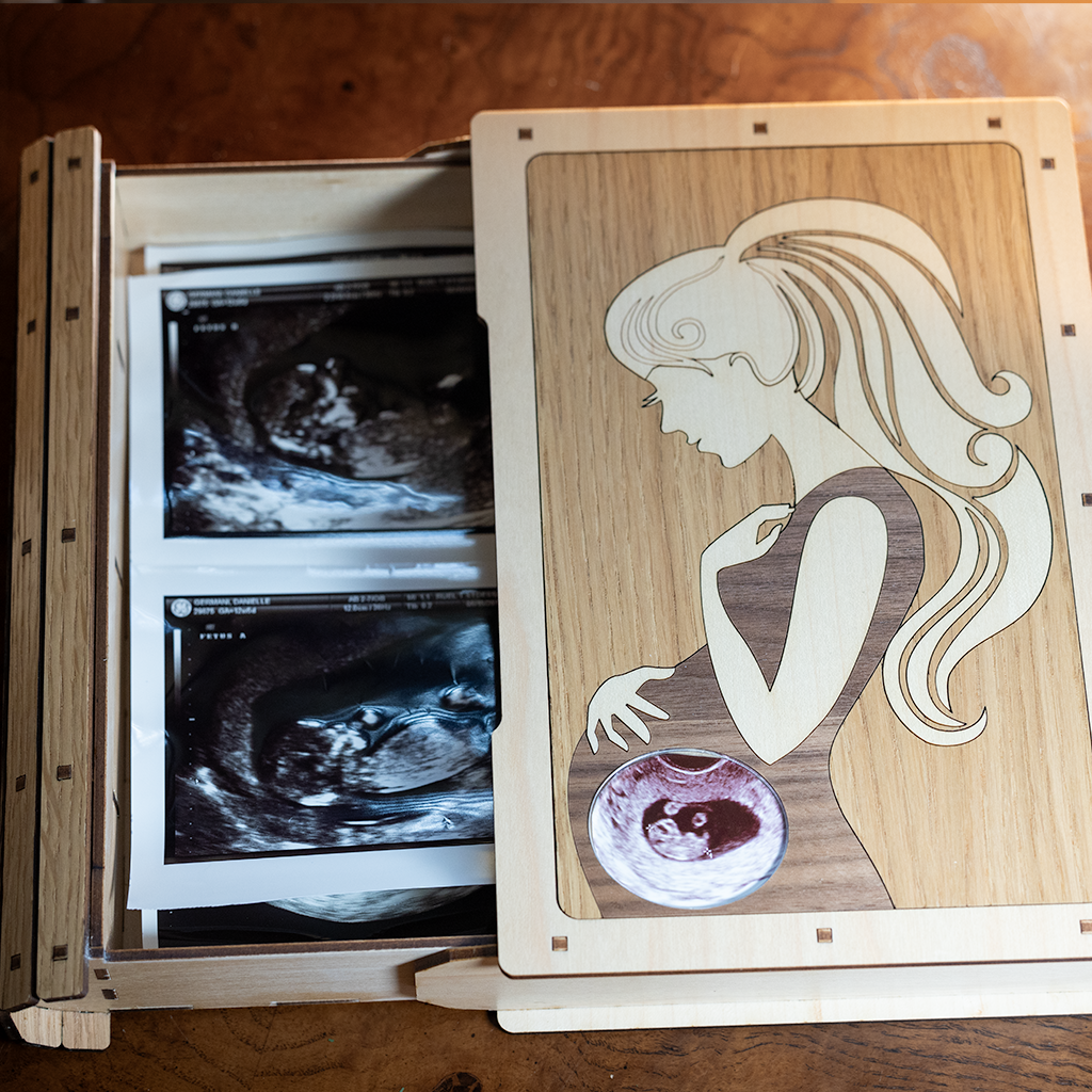 Sonogram Photo Box - Maple Hair